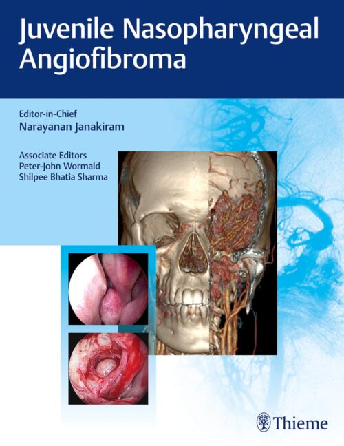 Juvenile Nasopharyngeal Angiofibroma 1st Edition