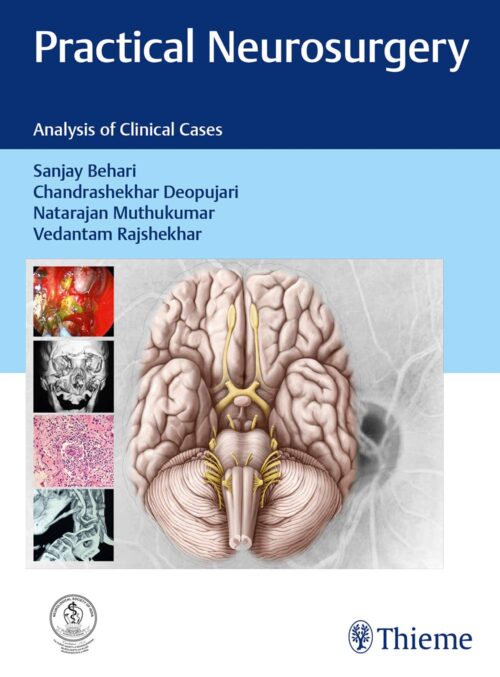 Practical Neurosurgery 1st Edition 2017