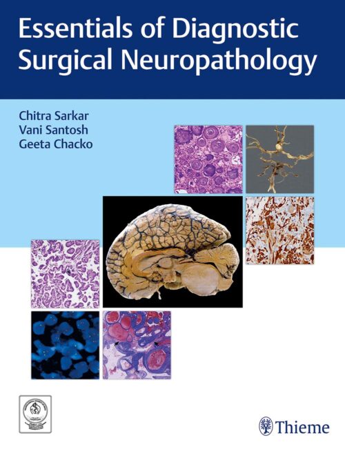 Essentials of Diagnostic Surgical Neuropathology 1st Edition