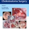 Atlas of Cavityless Cholesteatoma Surgery (Volume 1)