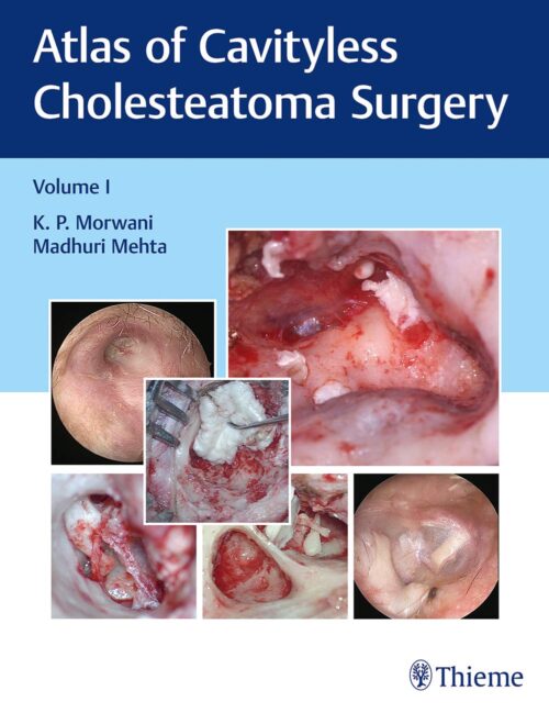 Atlas of Cavityless Cholesteatoma Surgery (Volume 1)