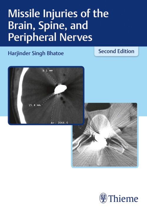 Missile Injuries of the Brain, Spine, and Peripheral Nerves 2nd Ed.