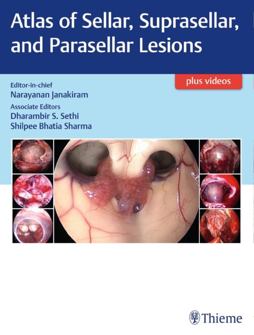 Atlas of Sellar, Suprasellar, and Parasellar Lesions 1st Ed.