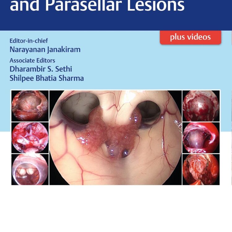 Atlas of Sellar, Suprasellar, and Parasellar Lesions 1st Ed.