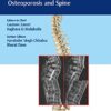 The ASSI Monographs - Osteoporosis and Spine