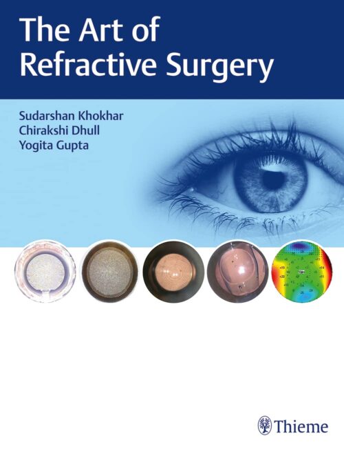 The Art of Refractive Surgery 1st Ed.