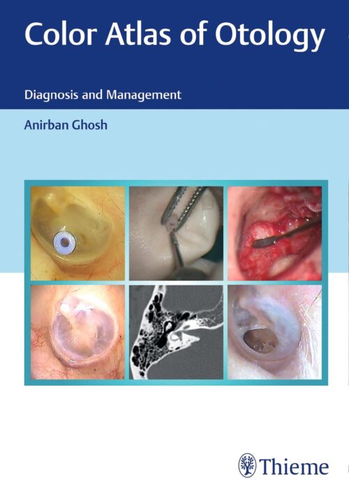 Color Atlas of Otology 1st Ed.