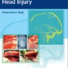 Surgical Nuances Of Head Injury 1st Ed.