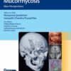 Invasive Skull Base Mucormycosis 1st Ed.