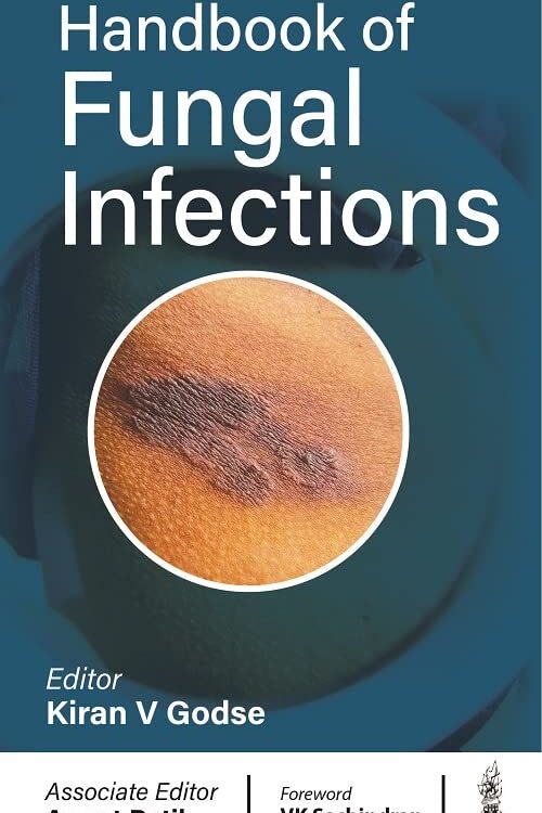 HANDBOOK OF FUNGAL INFECTIONS