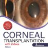 CORNEAL TRANSPLANTATION