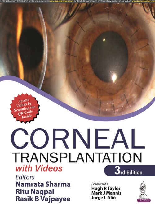 CORNEAL TRANSPLANTATION