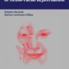 Minimally Invasive Techniques of Oculofacial Rejuv 1st Edition 2005