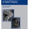 Challenging Cases in Spine Surgery 1st Edition 2005