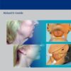 Neck Rejuvenation 1st Edition 2011