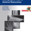 Radiographic Atlas of Skeletal Maturation 1st Edition 2012