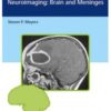 Differential Diagnosis in Neuroimaging Brain and Meninges 1st Edition 2016