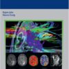 Brain Tumor Imaging 1st Edition 2015