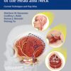 Reconstructive Plastic Surgery of the Head and Neck 1st Edition 2016