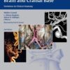 Vasculature of the Brain and Cranial Base 2nd Edition 2015