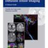 Diffusion Weighted and Diffusion Tensor Imaging A Clinical Guide 1st Edition 2015