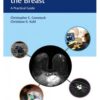 Abbreviated MRI of the Breast : A Practical Guide 1st Edition 2018