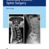 Instrumentation for Minimally Invasive Spine Surgery 1st Edition 2020