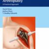 Reverse Shoulder Arthroplasty 1st Edition 2017