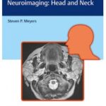 Differential Diagnosis in Neuroimaging Head and Neck 1st Edition 2016