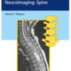 Differential Diagnosis in Neuroimaging Spine 1st Edition 2017