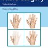 Hand Surgery : Tricks of the Trade 1st Edition 2020