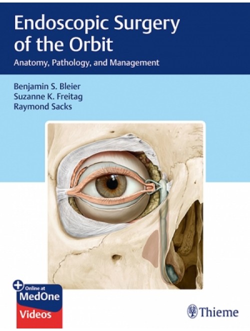 Endoscopic Surgery of the Orbit 1st Edition 2018