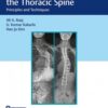 Surgery of the Thoracic Spine 1st Edition 2019