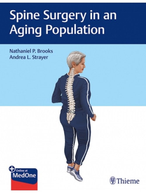 Spine Surgery in an Aging Population 1st Edition 2019