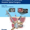 Essential Step-by-Step Techniques for Minimally Invasive Spinal Surgery 1st Edition 2023