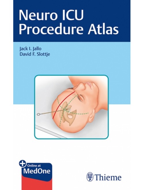 Neuro ICU Procedure Atlas 1st Edition 2021