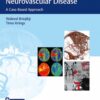 Imaging in Neurovascular Disease 1st Edition 2019