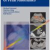 Ultrasound Diagnosis of Fetal Anomalies 1st Edition 2003