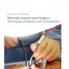 Minimally Invasive Spine Surgery-Techniques Eviden 1st Edition 2012