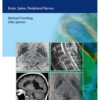 MR Neuroimaging : Brain, Spine, and Peripheral Nerves 1st Edition 2016