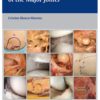 Atlas of Arthroscopic Anatomy of Major Joints 1st Edition 2016