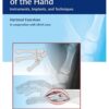 Osteosynthesis of the Hand : Instruments, Implants, and Techniques 1st Edition 2016