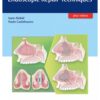 Nasoseptal Perforations: Endoscopic Repair Techniques 1st Edition 2017