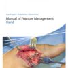 AO Manual of Fracture Management - Hand 1st Edition 2016