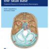 Meningiomas of the Skull Base 1st Edition 2018