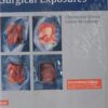 Atlas of Orthopaedic Surgical Exposures Indian Reprint 1st Edition 2015