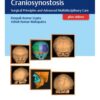 Tenets of Craniosynostosis 1st Edition 2018