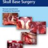 Atlas of 360 Degree Skull Base Surgery 1st Edition 2021