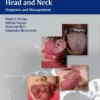 Vascular Lesions of the Head and Neck 1st Edition 2015