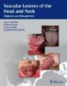 Vascular Lesions of the Head and Neck 1st Edition 2015